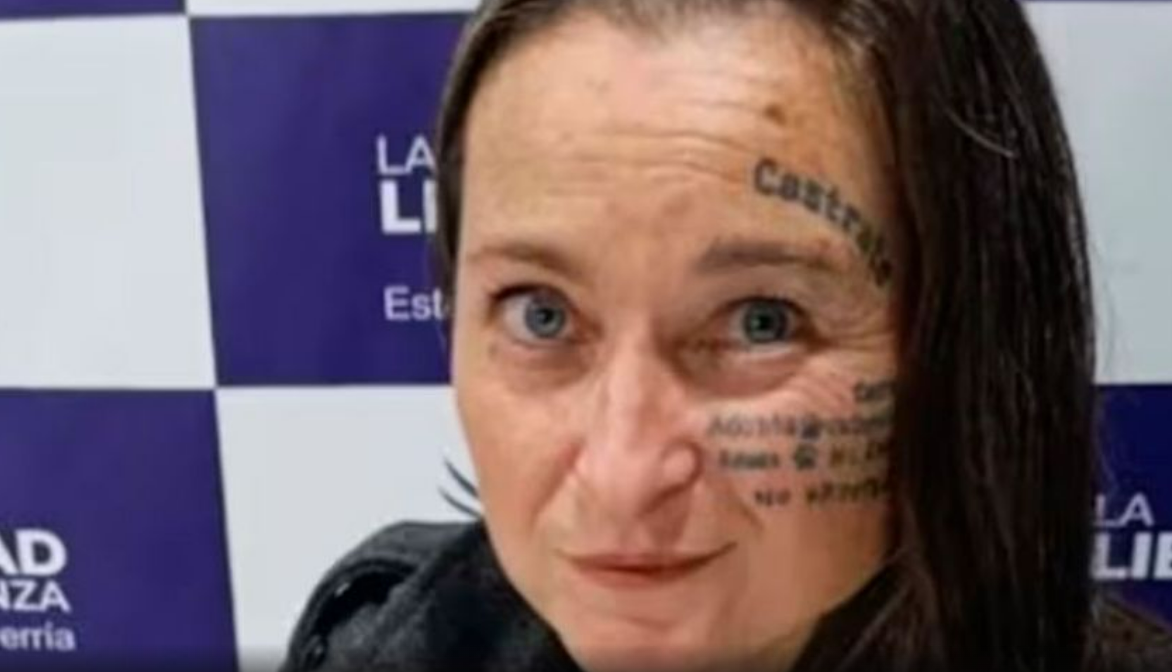 Candidata libertaria de Esteban Echeverría se borró tatuajes de la cara para que no la consideren «feminista»